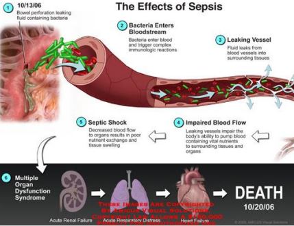 دانلود جزوه بیماری های عفونی (منابع فیزیوپات)