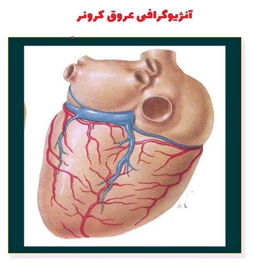 دانلود مراقبت‌های پرستاری پس از آنژیوگرافی عروق کرونر(PDF)